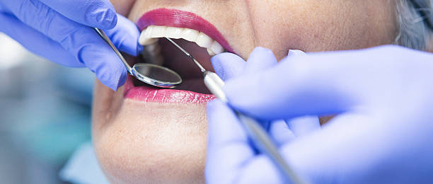 Best Emergency Dental Care for Broken or Chipped Teeth in Washington, PA